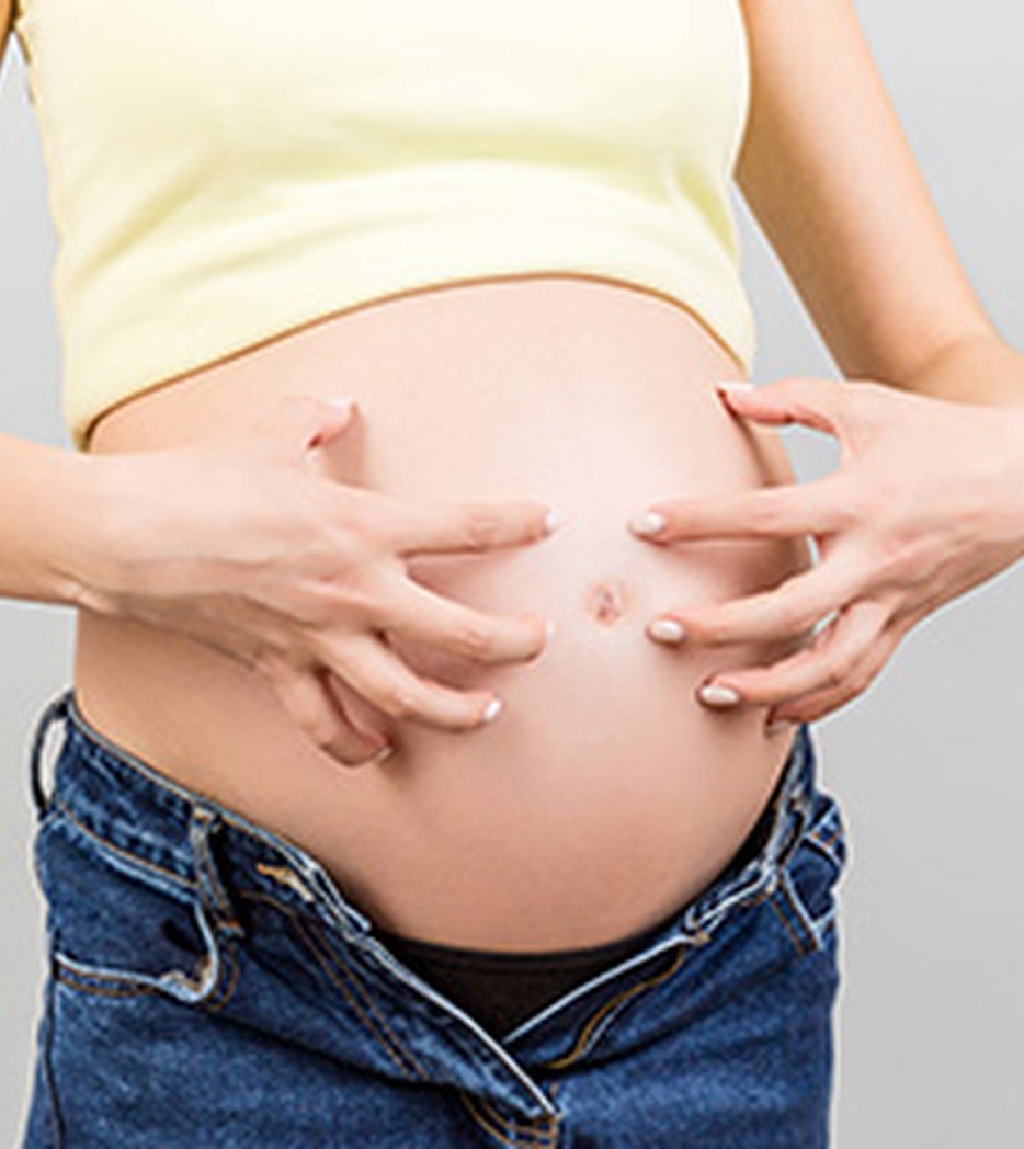 PUPPP in der Schwangerschaft: Wenn der Bauch stark juckt